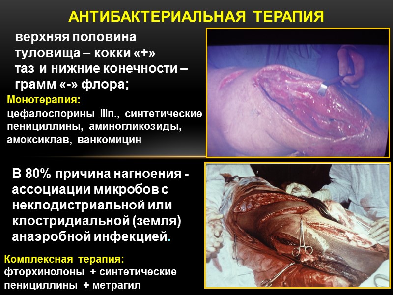 АНТИБАКТЕРИАЛЬНАЯ ТЕРАПИЯ В 80% причина нагноения -ассоциации микробов с неклодистриальной или клостридиальной (земля) анаэробной